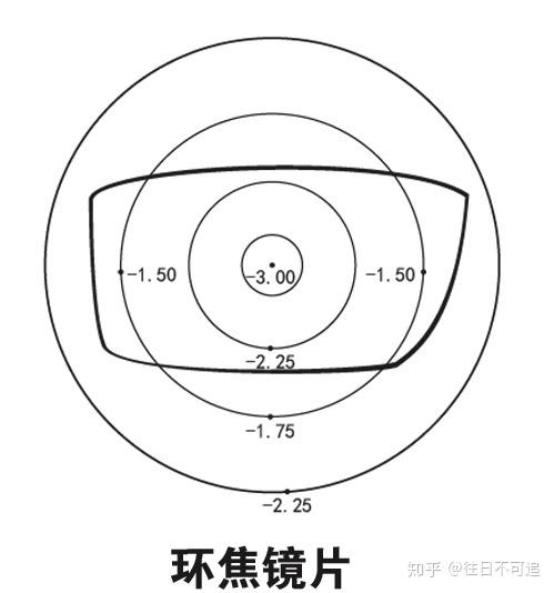 2,環焦鏡片——環焦鏡片也是模仿離焦原理設計,光度從中心向周邊規則