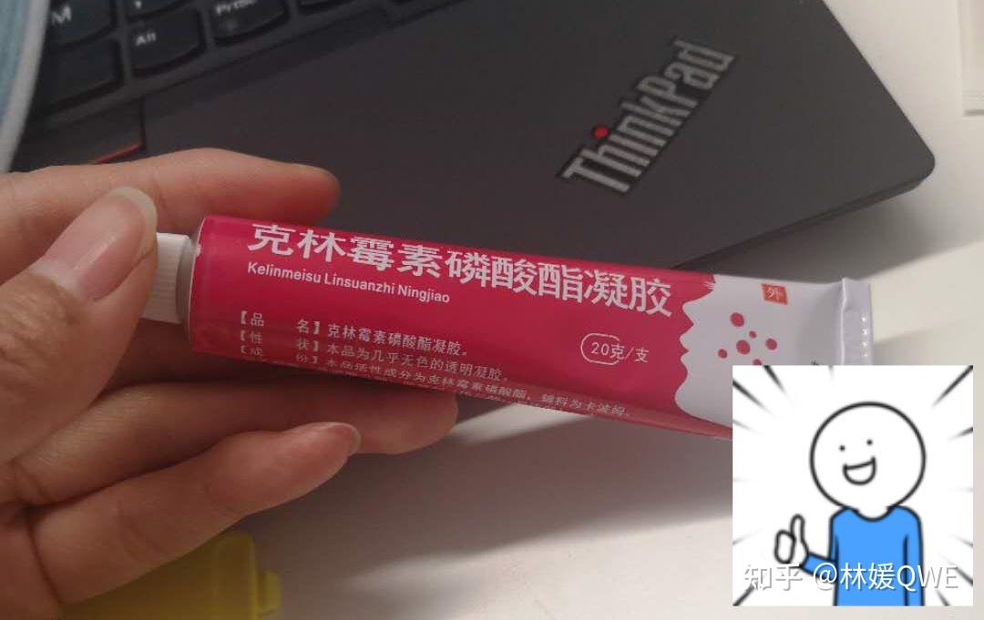 这个药膏的使用感很好,涂上冰冰凉,但是需要和过氧苯甲交叠使用,避免
