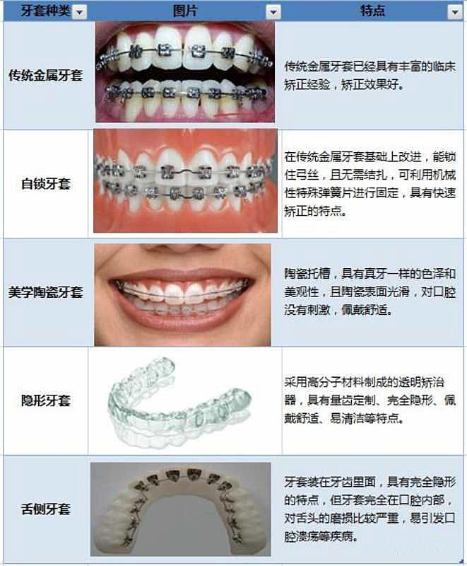 您需要了解的有关隐形牙套的一切 Smilepoint Dental