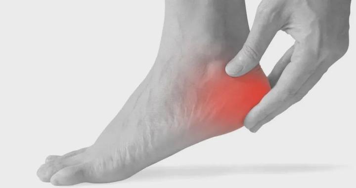 脚后跟痛应该怎么办？ - 知乎