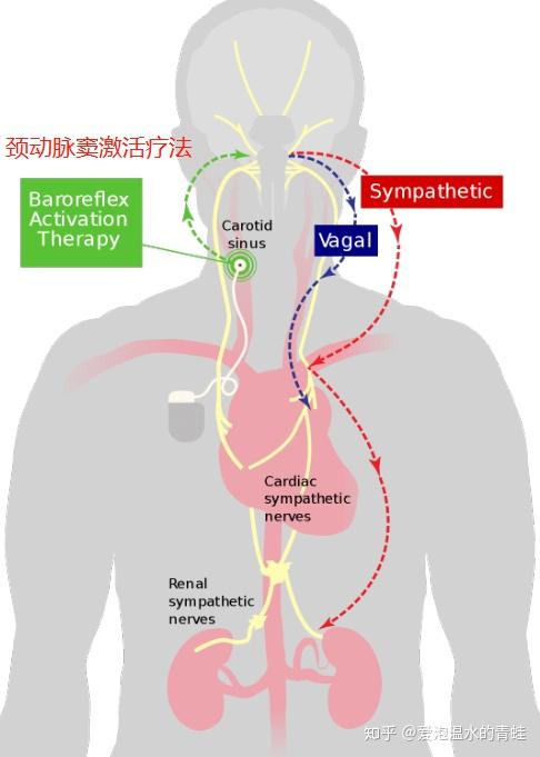 主动脉压力感受器图片