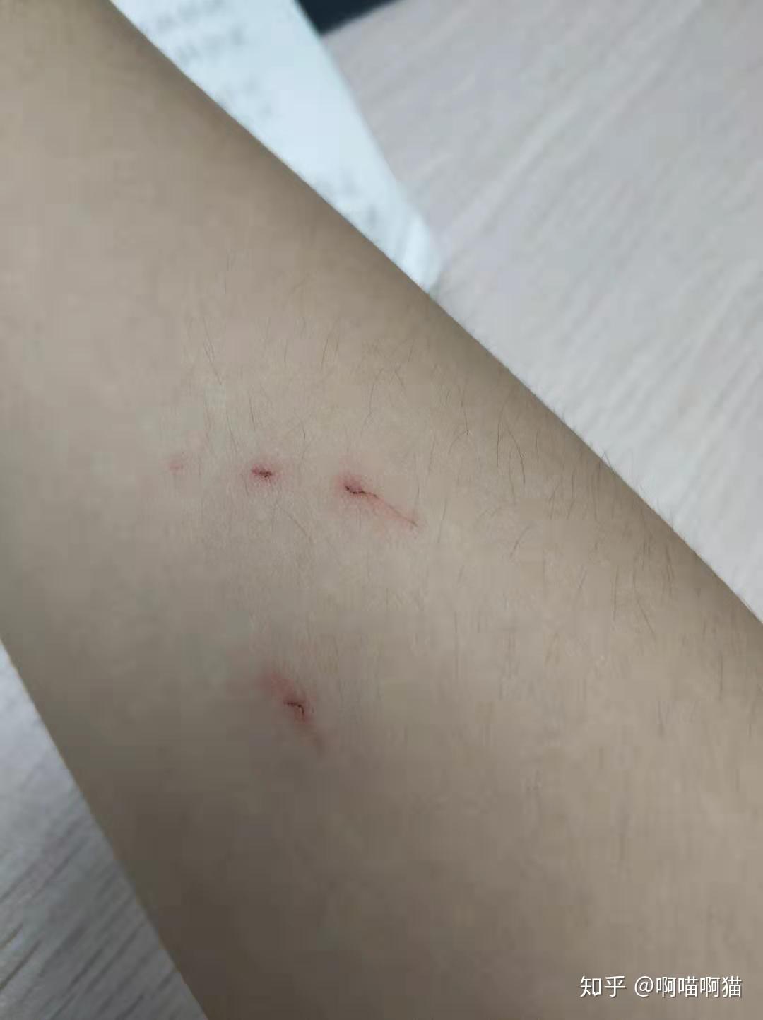 被布偶猫咬伤破皮了该怎么治疗