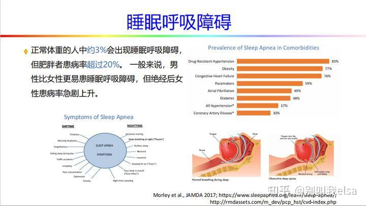 【深度科普贴】打鼾打呼噜怎么办?止鼾喷雾/鼻贴/牙套/喉部振动器/止鼾枕/呼吸机如何避坑?全网最全的近万字止鼾行业分析,深度解读,一文讲透。 - 知乎