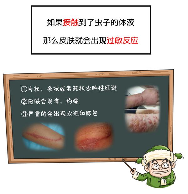 隱翅蟲落在身上究竟能不能拍? - 知乎