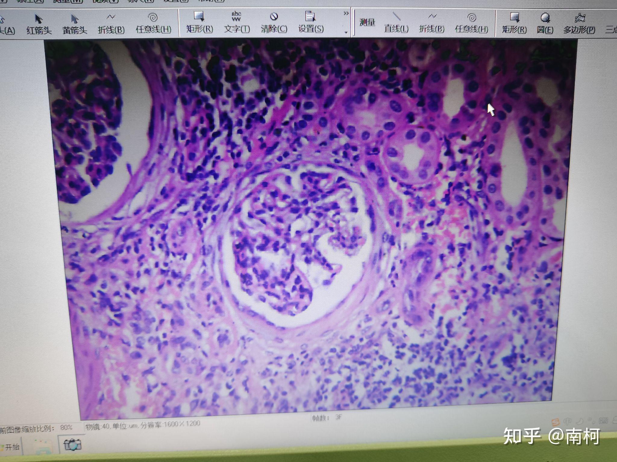 生理病理学红蓝铅笔图
