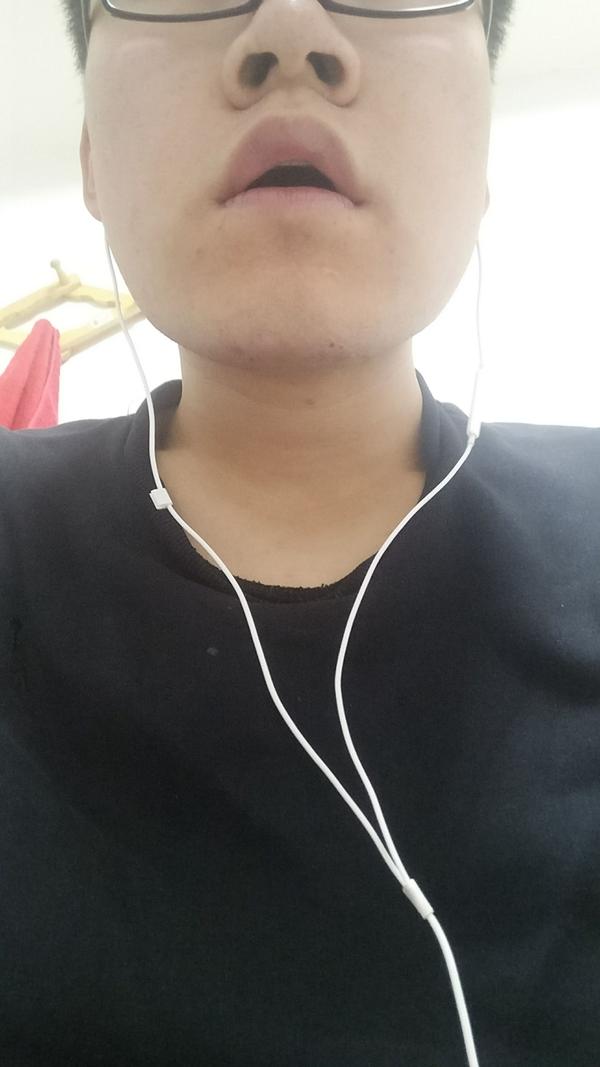 鼻孔大是什么感觉?