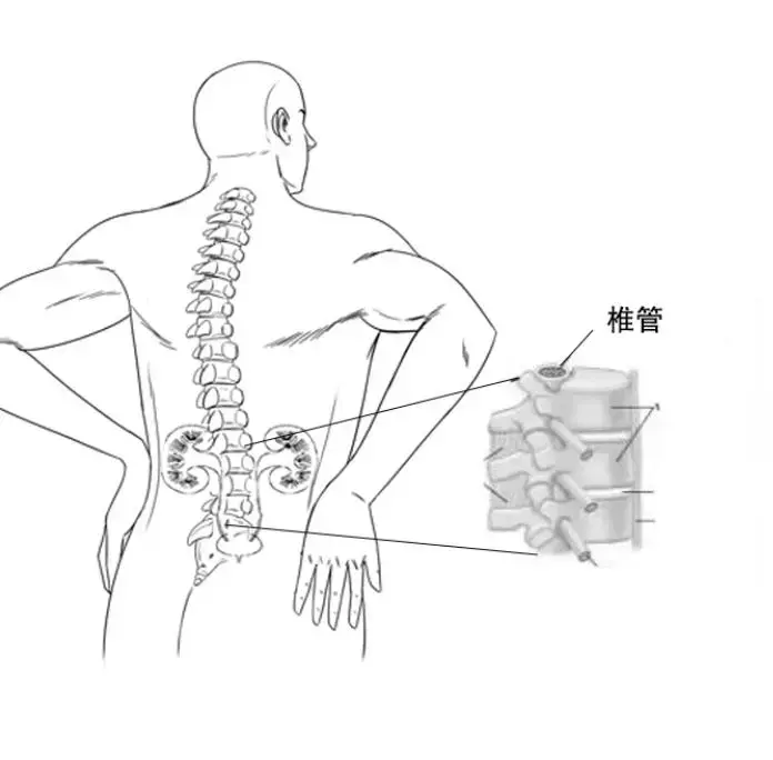 腰疼痛位置图图片