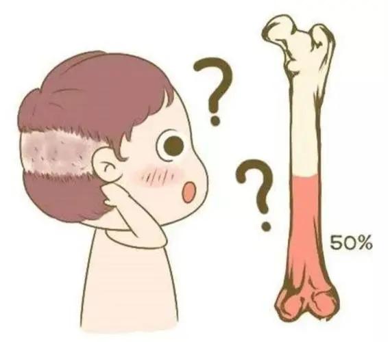 骨密度下降怎么办?如何恢复?