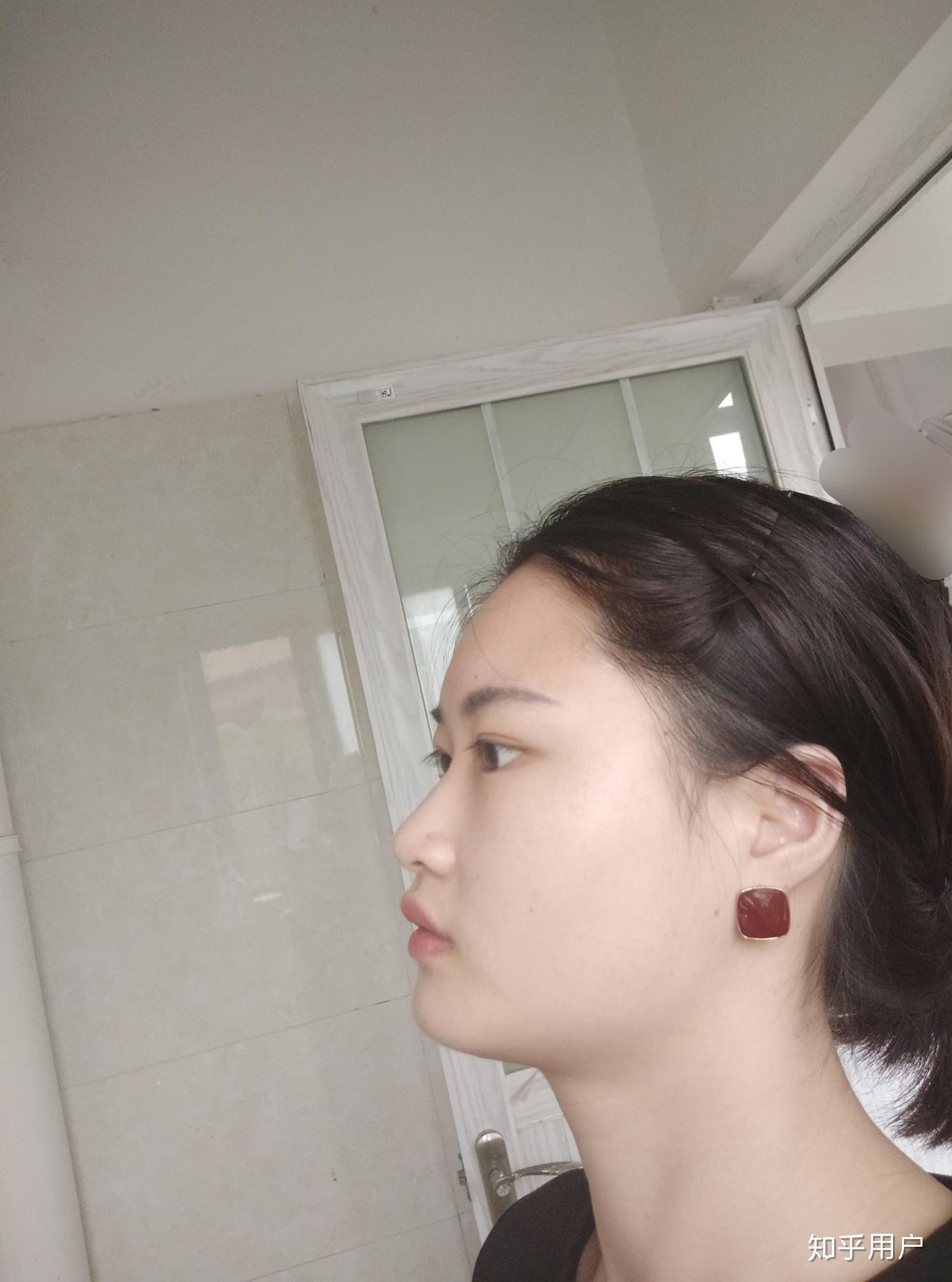 有一个超级扁平的侧脸是一种什么样的体验?