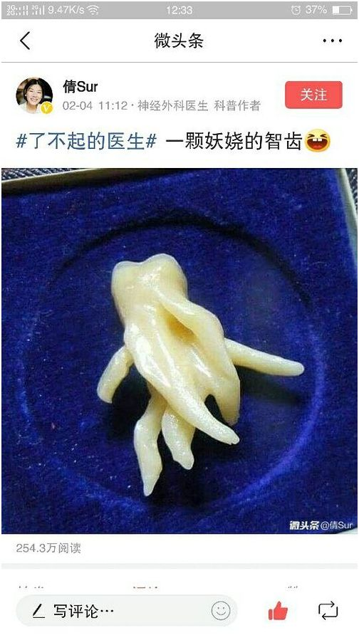 如果这颗智齿长在你的嘴巴里,是不是细思恐极呢?  显示全部