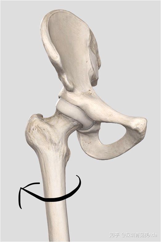 70%产生髋关节内旋的肌肉有阔筋膜张肌,髂胫束,这些肌肉过度紧张,产生