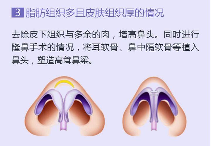 v2-78d0d09e5e9fcb1eec7b3bcc3457061d_1440w.jpg?source=172ae18b