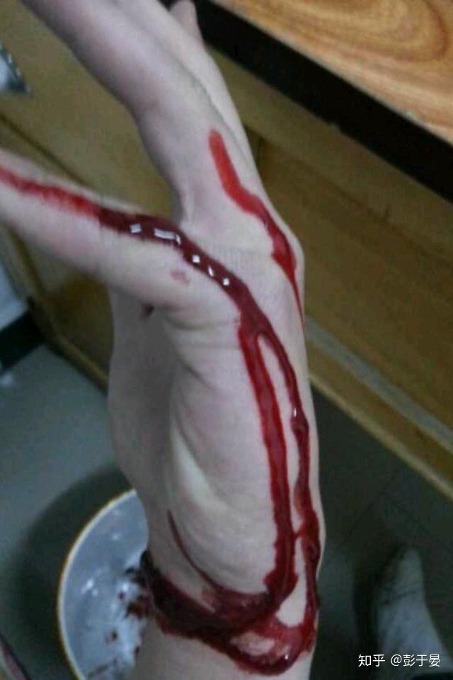 男生割脉手流血的照片图片