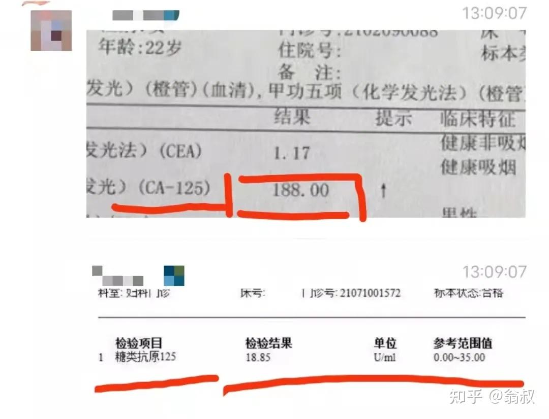 對子宮內膜異位症患者來說ca125和ca199有什麼區別