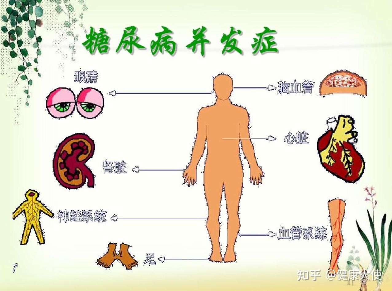 血糖高一定是糖尿病嗎