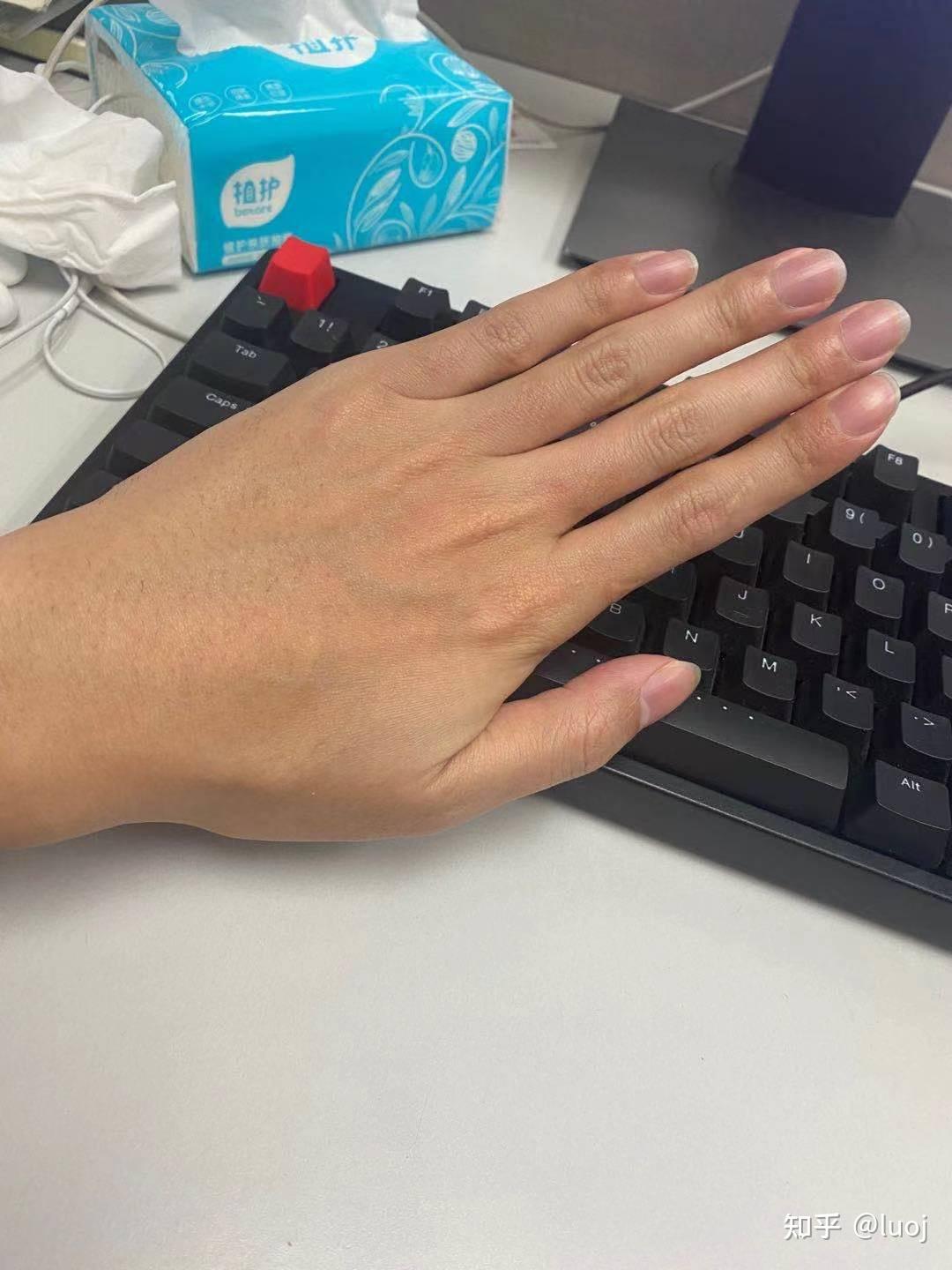 手指上长毛是一种什么样的体验?