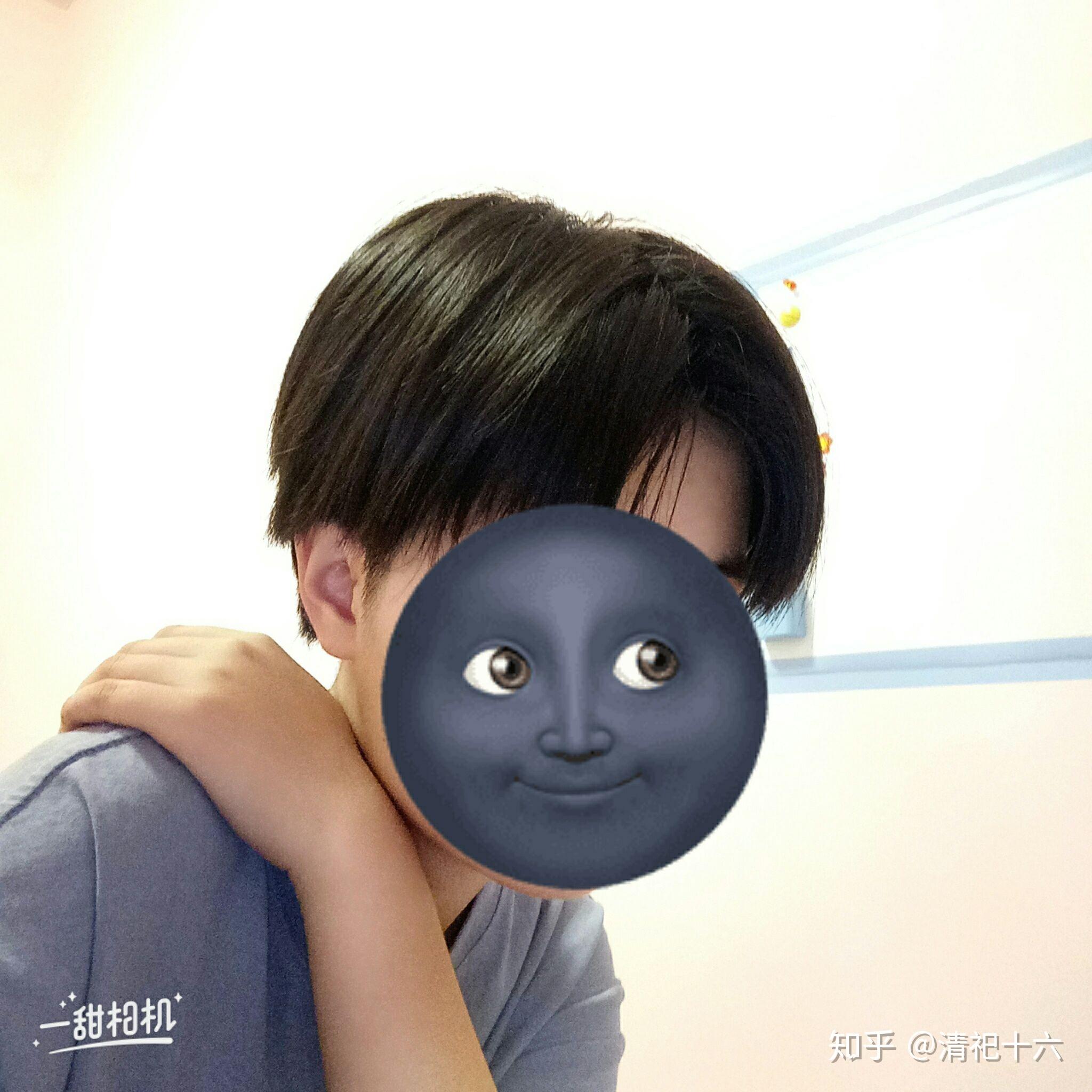 凸嘴 戴眼镜 适合日系少年短发吗? - 知乎