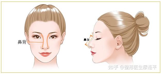 鼻子审美(十一)-鼻背的美学 - 知乎