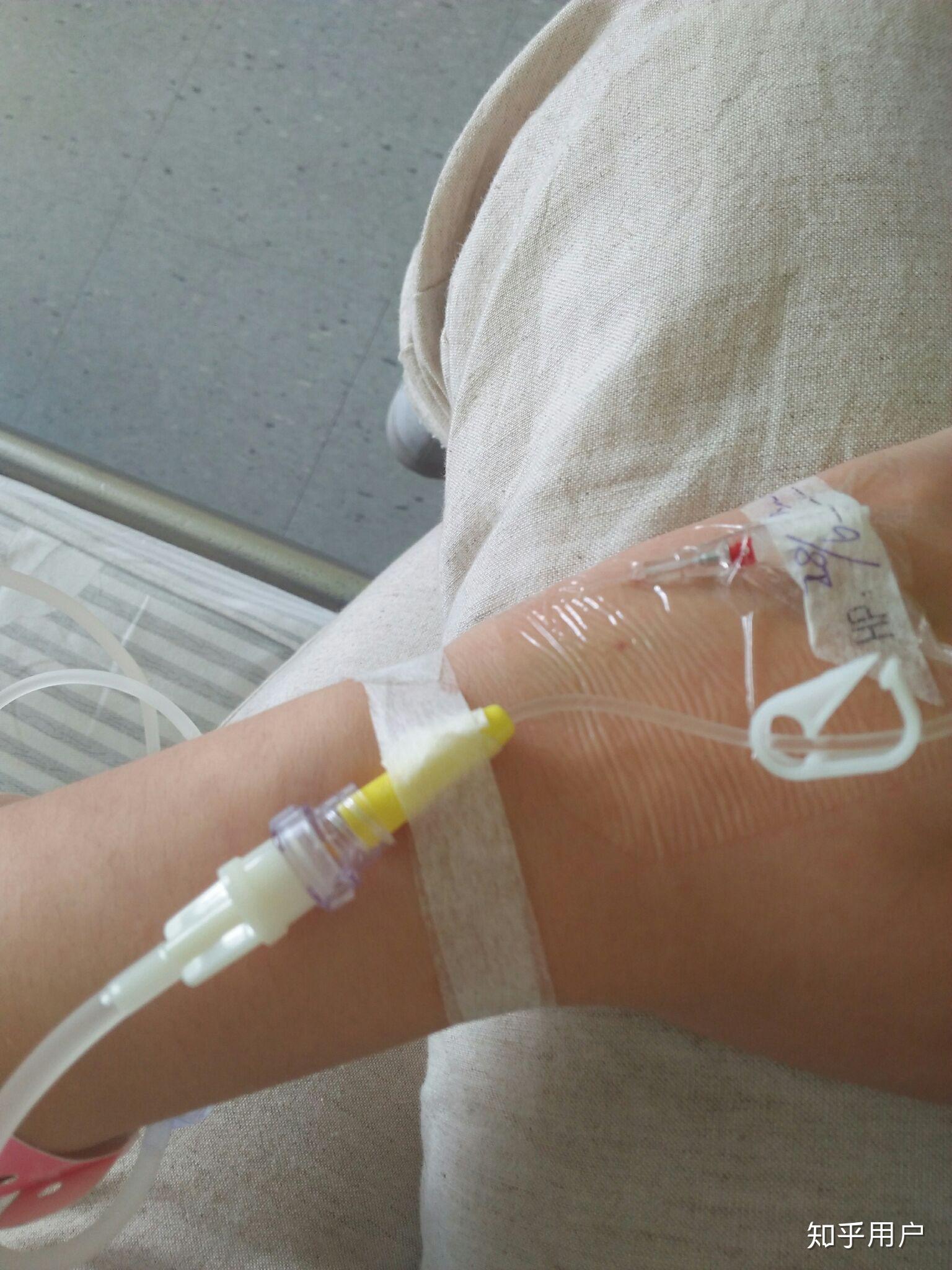 为什么静脉注射阿奇霉素对血管刺激这么严重