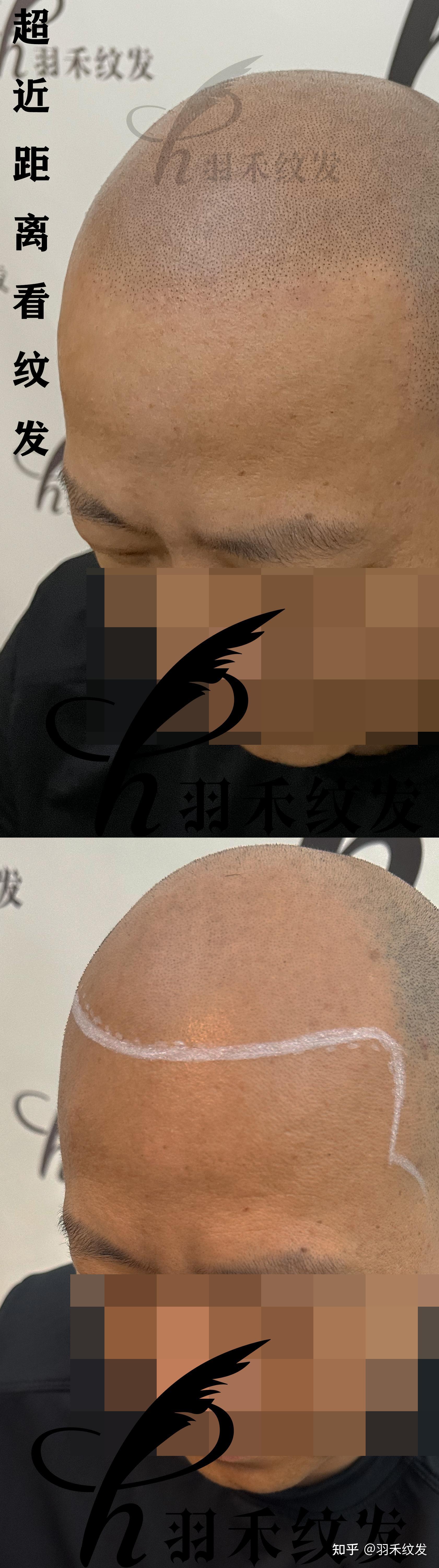 纹发的流程是什么？ - 知乎