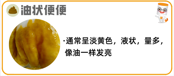 22种宝宝大便图文详解,出现这10种必须警惕! - 知乎