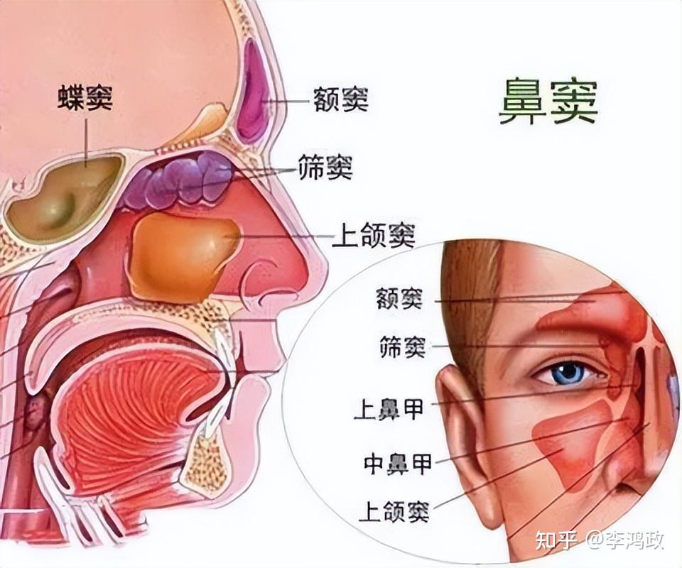 鼻窦炎,连根拔起!可能么?看下去就知道了.