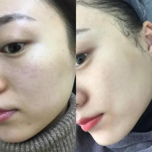 什么办法可以快速补充维C v2-7a4b87591f75e0b962a8ac2216ff9ae9_1440w.jpg?source=172ae18b