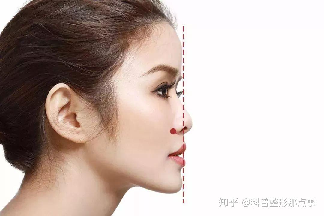 v2-7a523ac1cfafb7cc5bcf724059ae4280_r.jpg