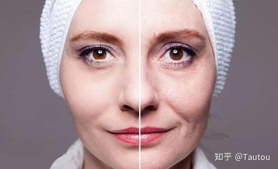 什么叫做脱水 v2-7a6692c2144b41aae8f1a3cdf7f790c8_r.jpg