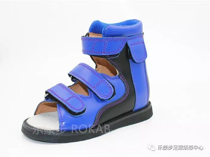 尖足矫正临床效果分析