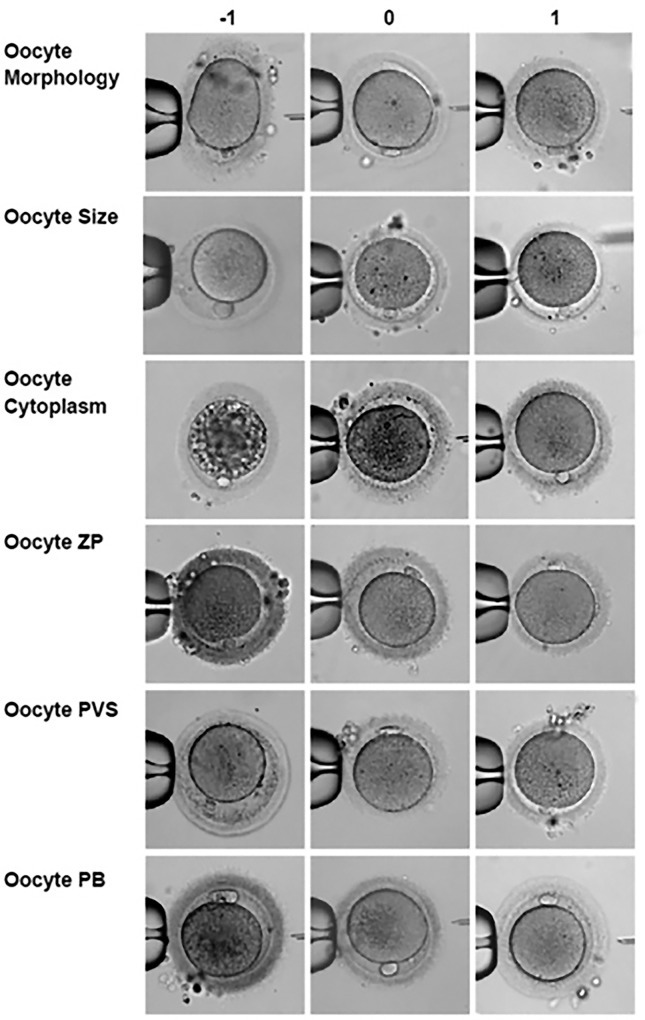 怎么样卵子算的上漂亮