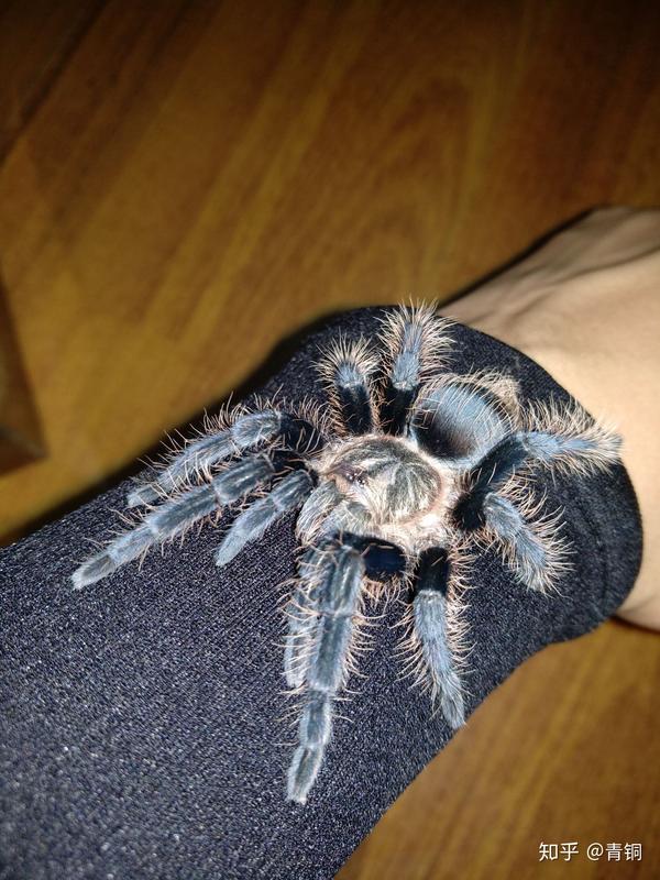 你有没有过被别人用异样的眼光看待?