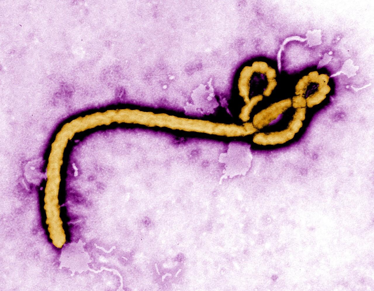 埃博拉病毒长什么样图片