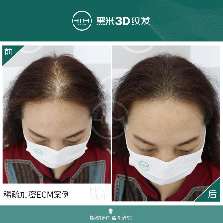 纹发知识科普：3d纹发有哪些应用？ - 知乎