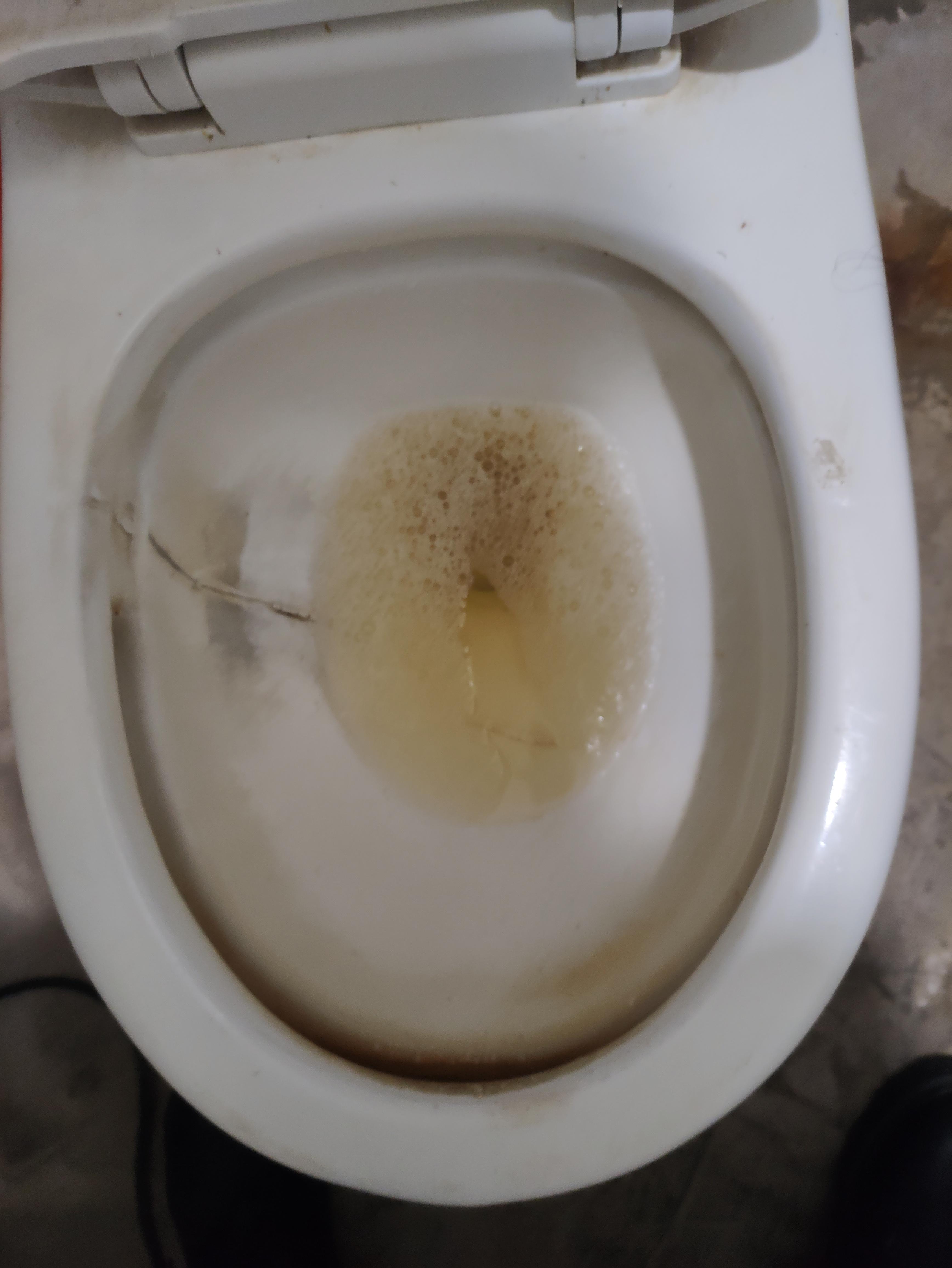 关注问题 ​ 写回答 登录/注册 泌尿 泌尿外科 小便泡沫多是肾有