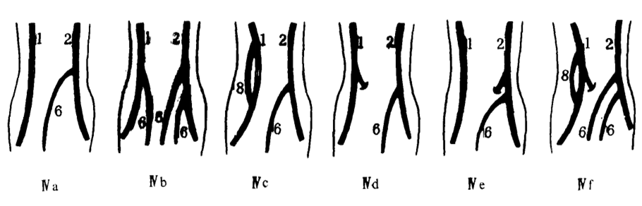 肘正中静脉(median cubital vein)的变数是最大了,一般指的是连接头