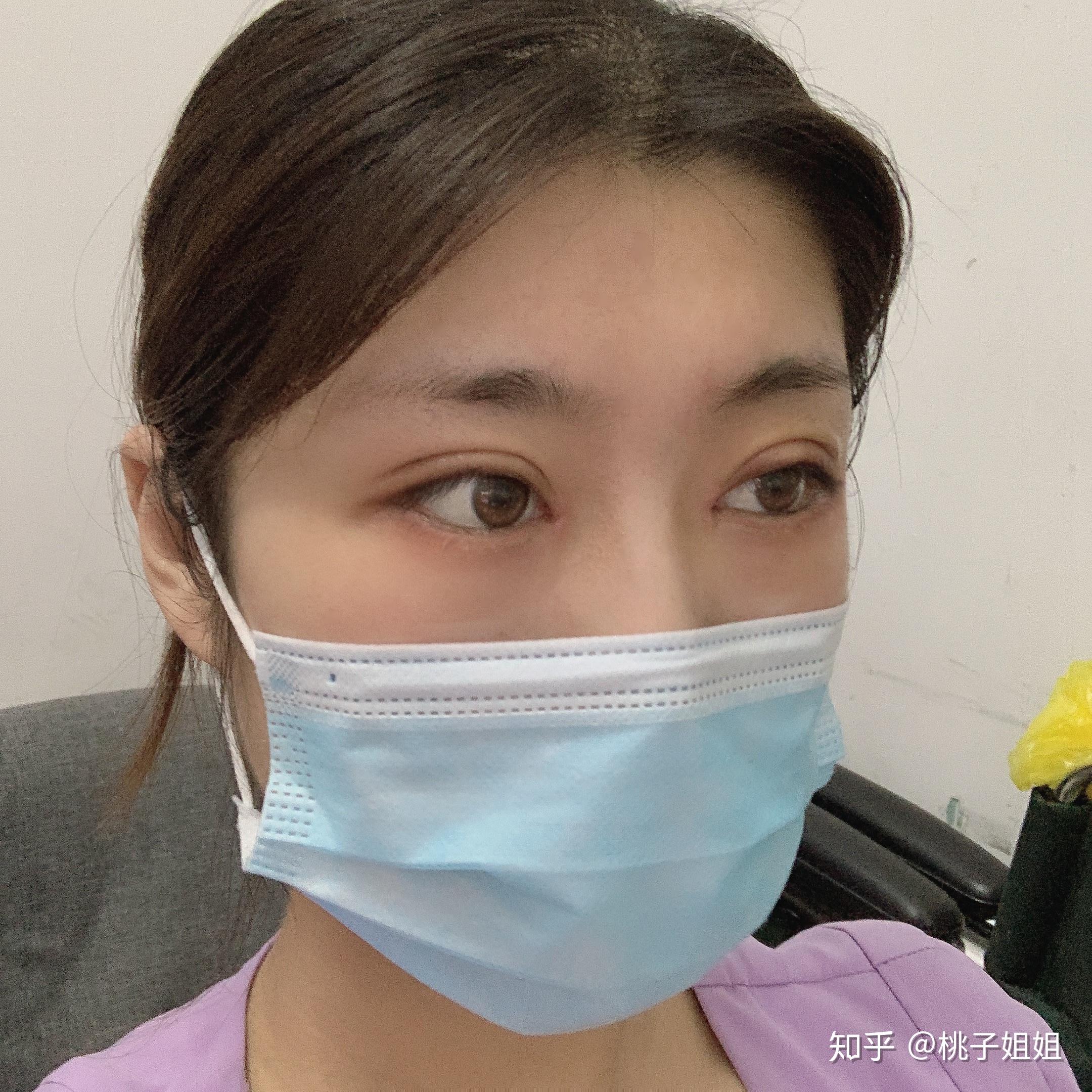 北京八大处双眼皮——附整形医院医生名单与护理方式 - 知乎
