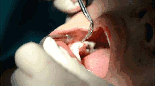 v2-7b31ccd486ef82153242ee85bd2b7254_r.jpg