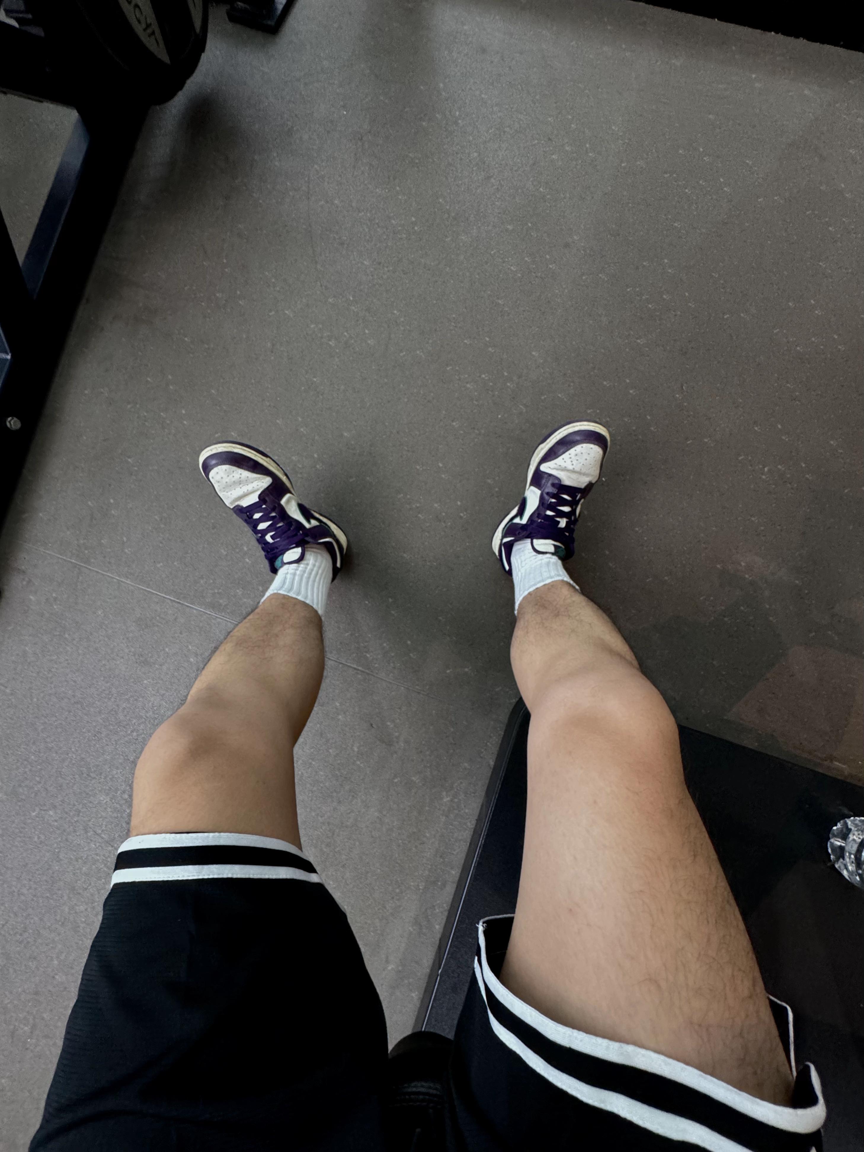 男生腿毛太多怎么办啊?