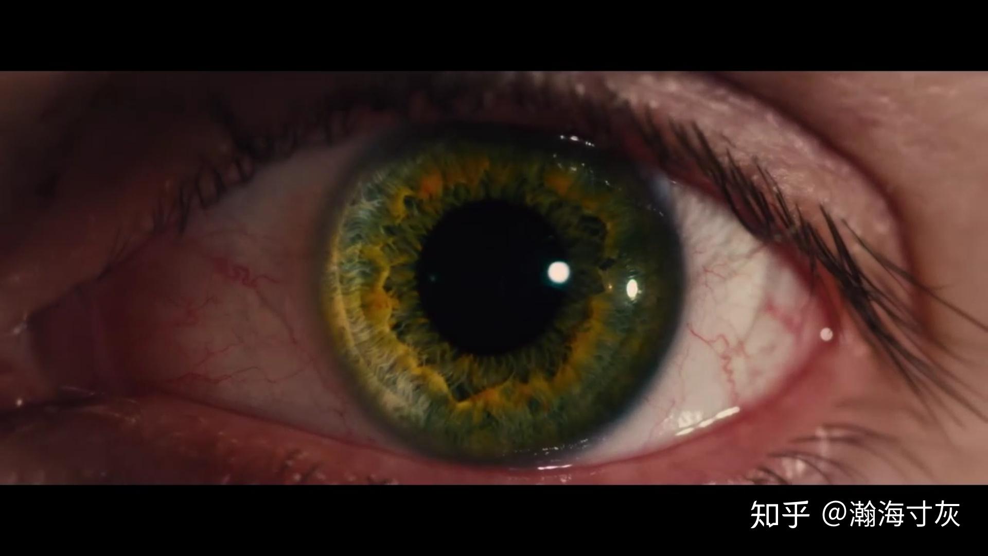 虹膜异色是种什么样的体验