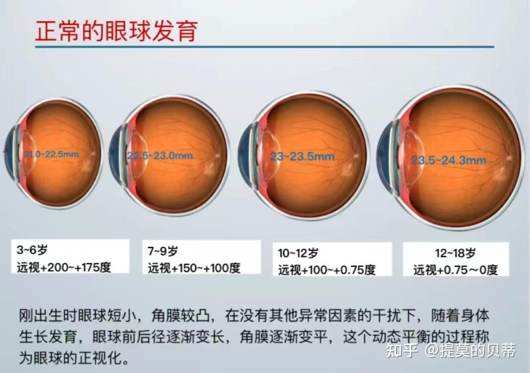 散光100度严重吗图片