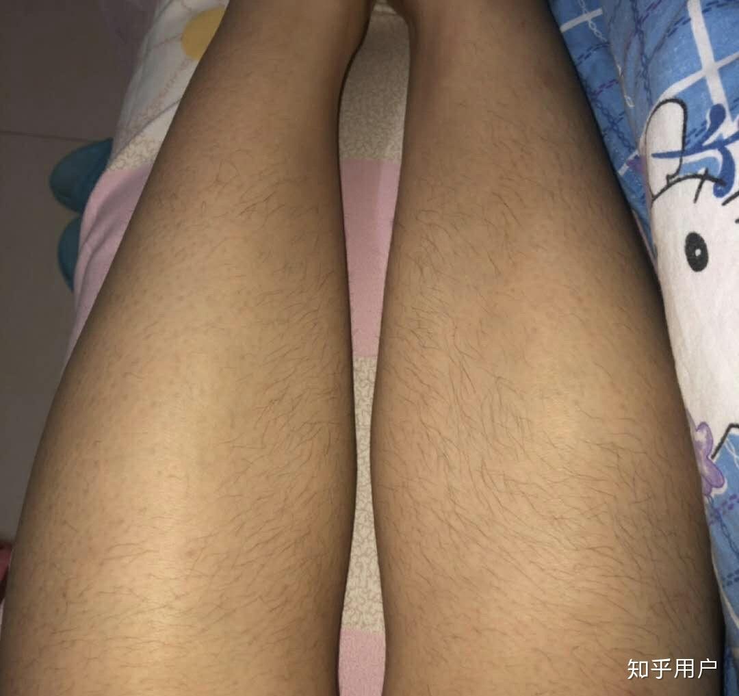 为什么现在很多男生都没腿毛了