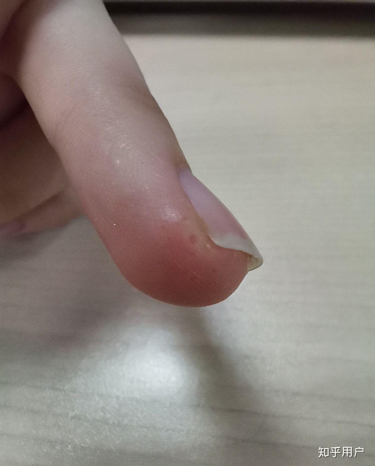 空手指莲蓬乳是真的吗