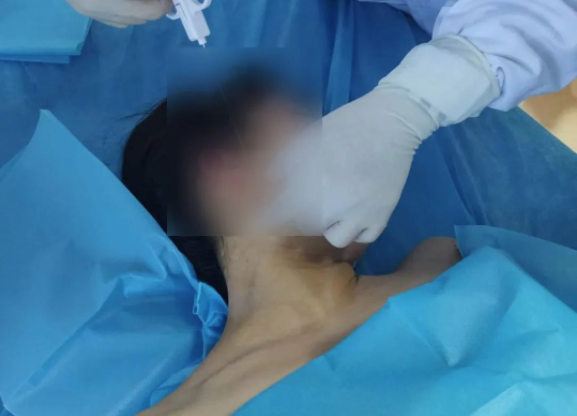 一针辨真伪——超声引导下颈部淋巴结穿刺活检1例