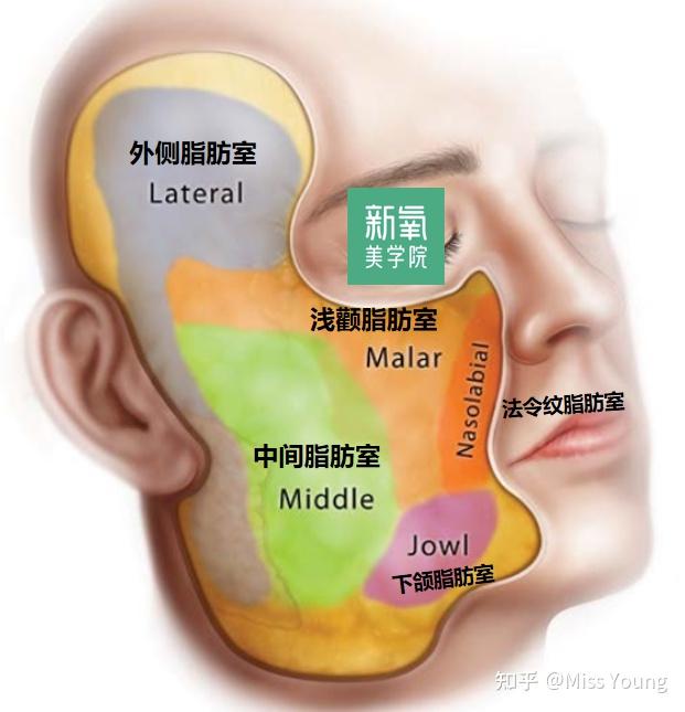 脂肪室的衰老和位移表现,是从原来的一块变成三,四块,有非常明显的