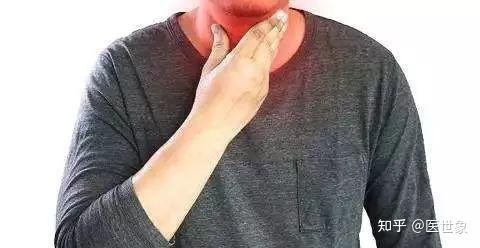 别把喉癌当成咽炎!若颈部有这4种表现,建议引起重视 - 知乎