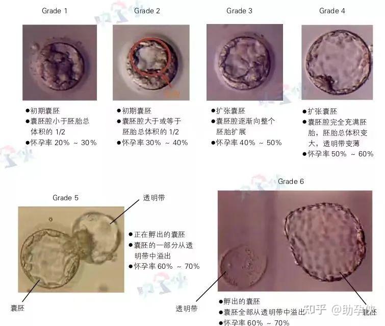 试管婴儿要不要养囊?先教你三招提高卵子质量! - 知乎
