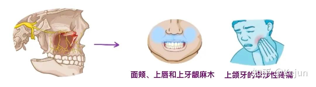 人体解剖学基础——三叉神经 - 知乎
