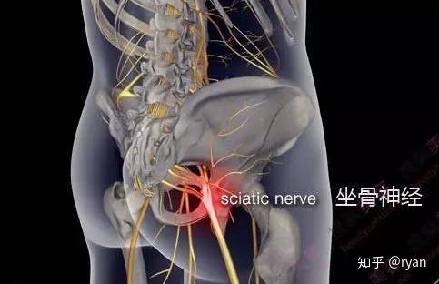 人体工学椅的网布坐垫是否会压迫大腿的血管和神经,网布坐垫肯定比