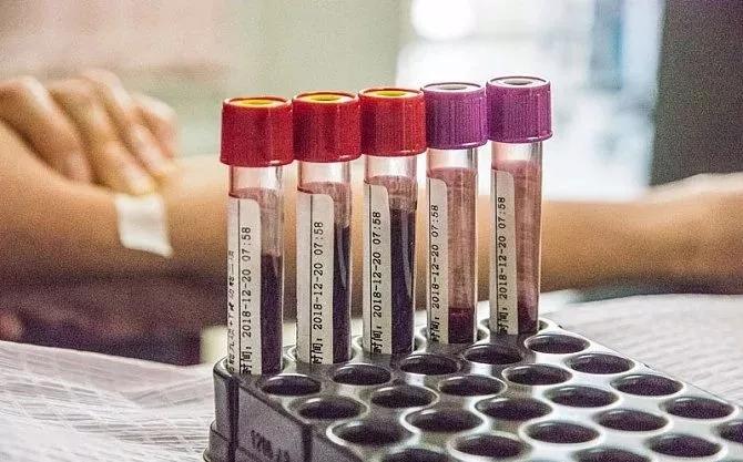 abo溶血你知多少